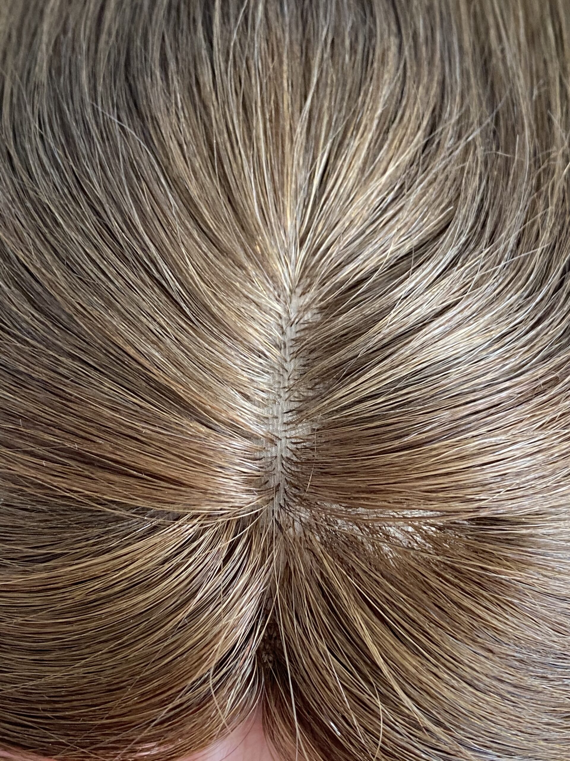 Silk base Human Hair Women Topper For Alopecia, 3x5 inch size - 图片 2